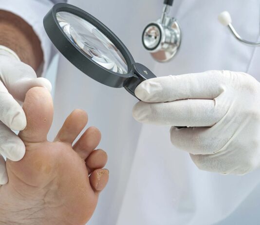 Антигрибкові засоби: вибір найкращих препаратів від грибка